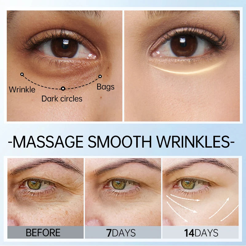 Peptide Eye Cream Dark Circles Remove Eye Bags Puffiness Reduces Wrinkles Lifting Firming Eye Serum Man Woman Eye Care Beauty